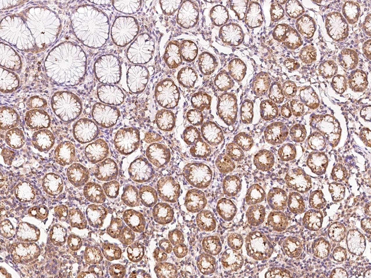 IL17F Antibody