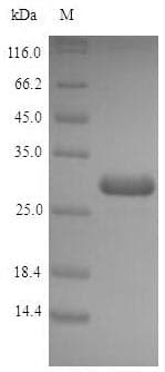 Escherichia coli acpP / Acyl Carrier Protein (Recombinant 6His-SUMO, N-terminus)