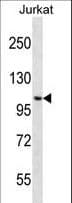 CENPC / CENP-C Antibody (aa395-424)