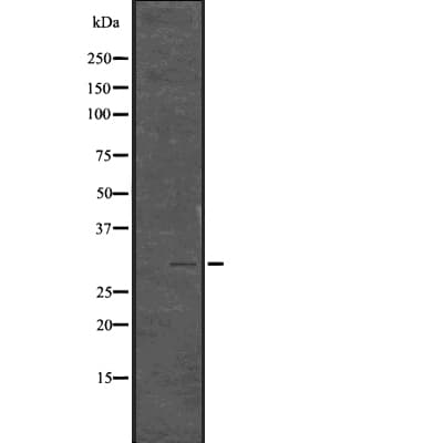 HIST1H1E Antibody (phospho-Thr17)