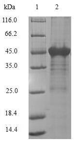 Human APRT Protein (Recombinant GST, N-terminus)