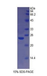 Bovine HLA-DRA Protein (Recombinant His)