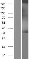 CD74 / CLIP Protein (Over-Expression Lysate Myc-DDK (Flag))