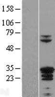 ZC4H2 Protein (Over-Expression Lysate Myc-DDK (Flag))