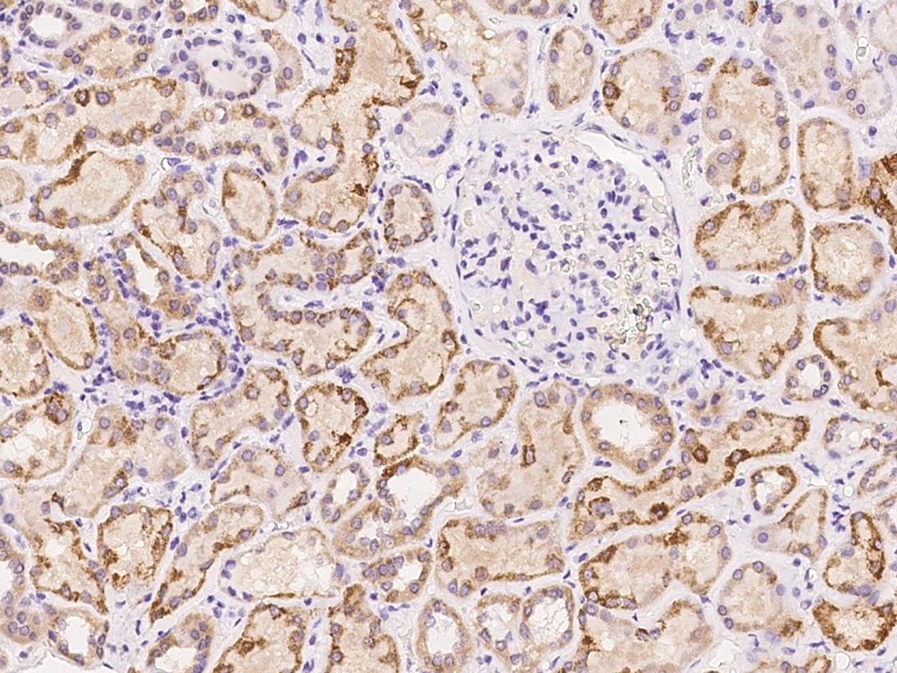 SLC16A4 Antibody