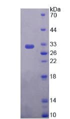 Human PLEC / Plectin Protein (Recombinant His, N-Terminal)