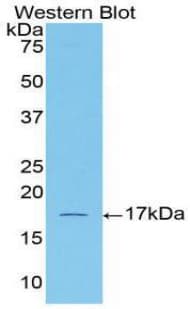 ACVR2 / ACVR2A Antibody (aa192-325, APC)