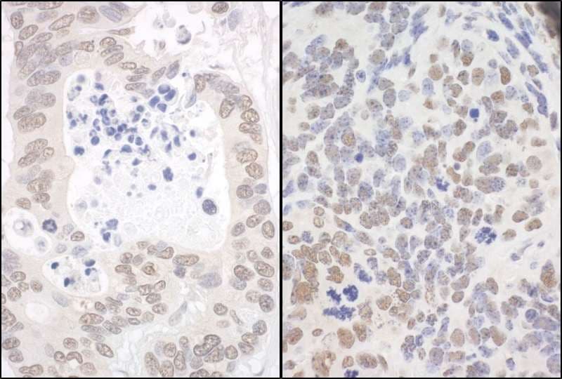 API5 Antibody (aa1-50)