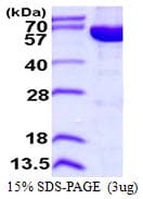 Human IMPDH2 Protein (Recombinant His)