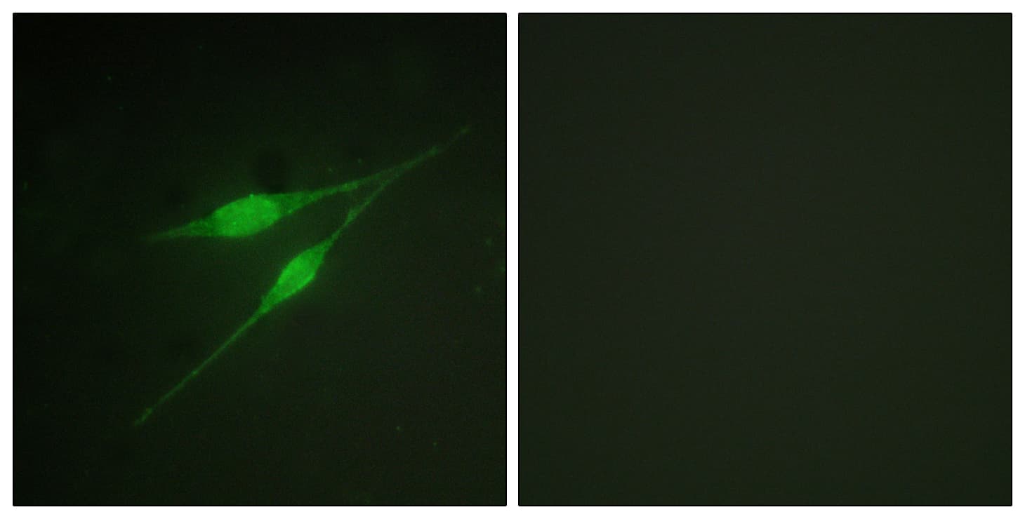 MAPK14 / p38 Antibody (aa288-337)