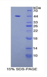 Mouse Complement C3 Protein (Recombinant His)