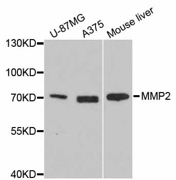 MMP2 Antibody