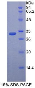 Mouse MAP3K5 / ASK1 Protein (Recombinant His-T7)
