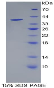 Human PPY / Pancreatic Polypeptide Protein (Recombinant His-GST)