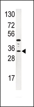 IGFBP3 Antibody (aa163-193)