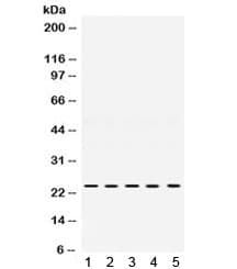 Polyclonal Rabbit anti-Human TIMP2 Antibody (WB)