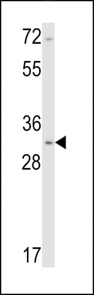 Polyclonal Rabbit anti-Human CNN1 / Calponin Antibody (aa10-39, IHC, WB)