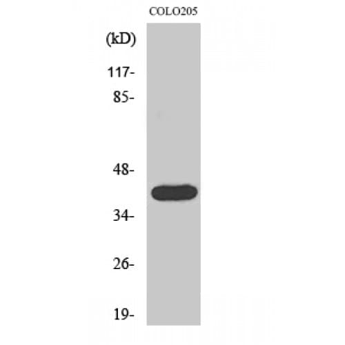 ACTG2 Antibody (1-80 aa, N-terminal)