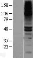 Human Renal Dipeptidase / DPEP1 Protein (Over-Expression Lysate Myc-DDK (Flag))