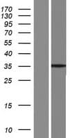SYCE1L Protein (Over-Expression Lysate Myc-DDK (Flag))
