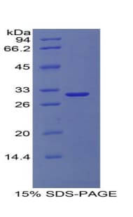 Human COL4A1 / Collagen IV Alpha1 Protein (Recombinant His, N-Terminal)