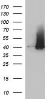 SERPINB3 Antibody (clone OTI2H2)
