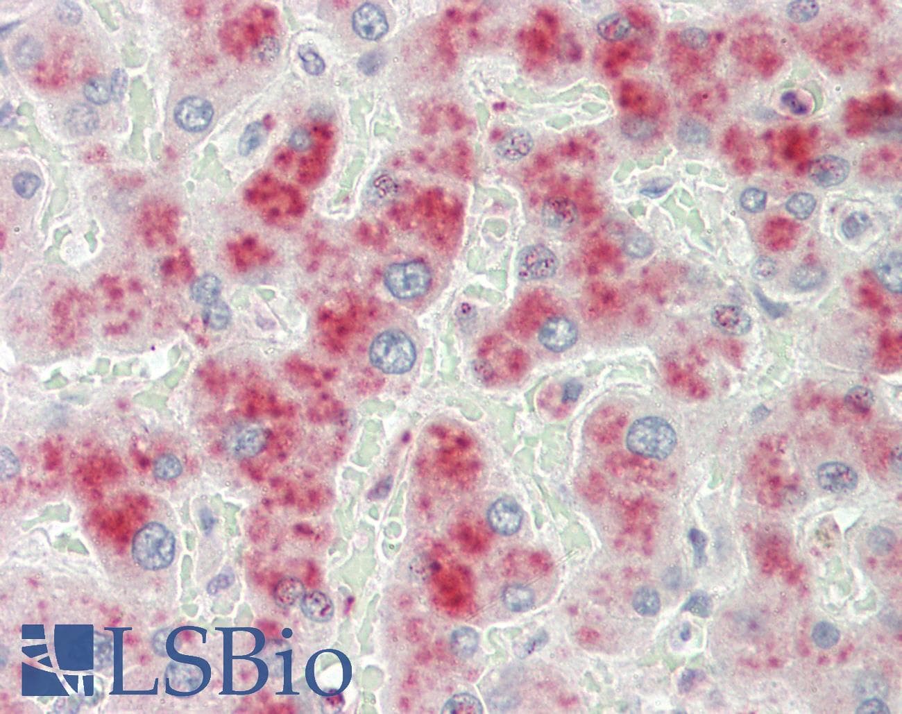 IHC-plus™ A2M / Alpha-2-Macroglobulin Antibody (aa417-430)