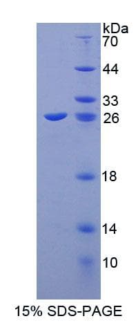 Human CIB1 / KIP Protein (Recombinant His-T7)