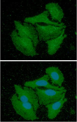 CALB2 / Calretinin Antibody (clone AT5C5)