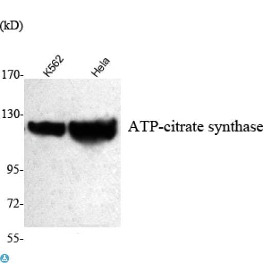 Monoclonal Mouse anti-Human ACLY / ATP Citrate Lyase Antibody (IF, WB)