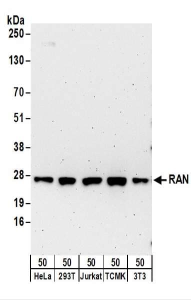 Polyclonal Rabbit anti-Human RAN Antibody (aa175-225, IHC, WB)