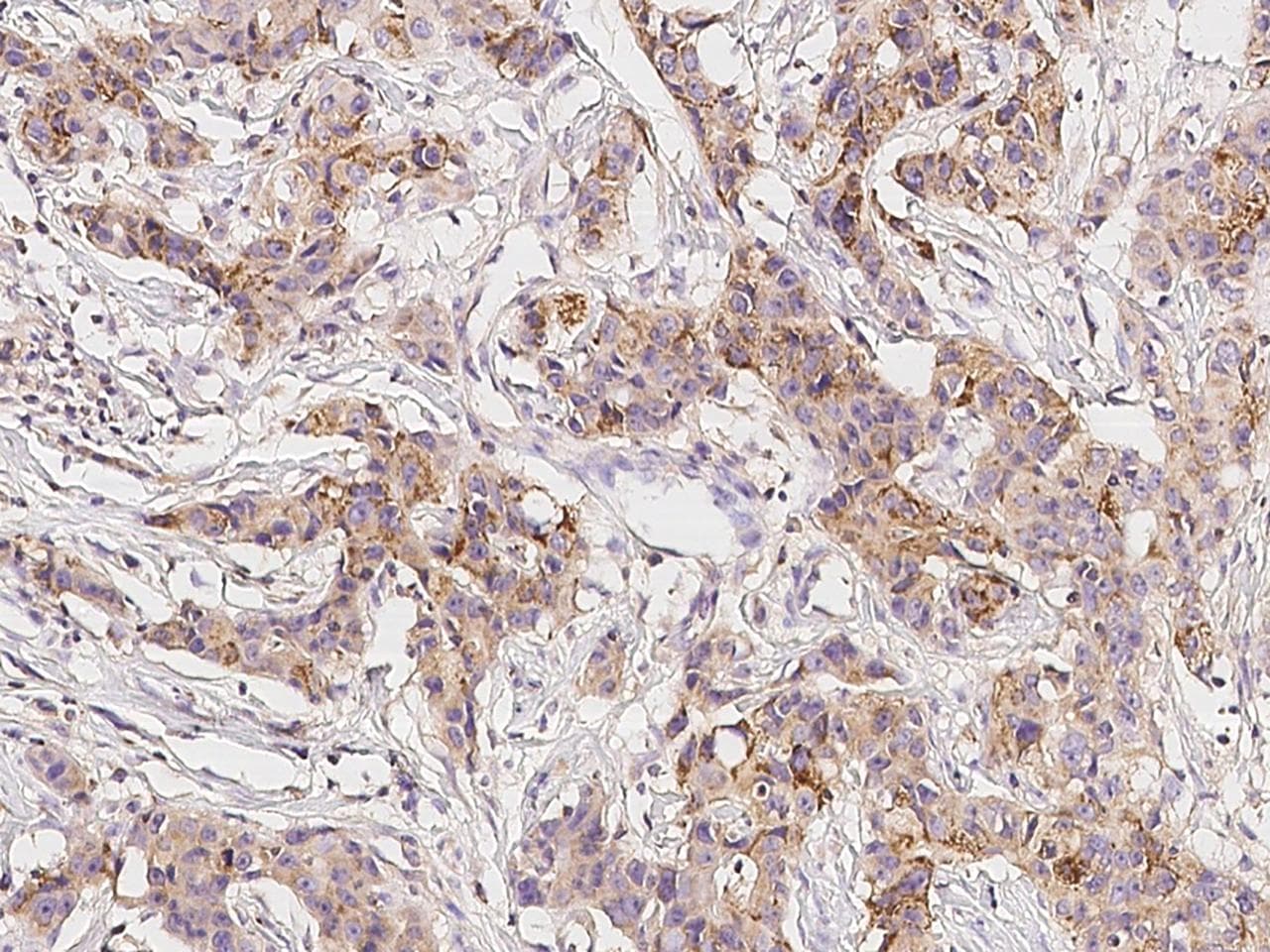 IL13RA1 / IL13R Alpha 1 Antibody