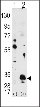 Polyclonal Rabbit anti-Human PIM1 / Pim-1 Antibody (IHC, WB)