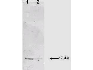 Polyclonal Rabbit anti-Human IL-1B / IL-1 Beta Antibody (N-Terminus, IHC, IF, WB)