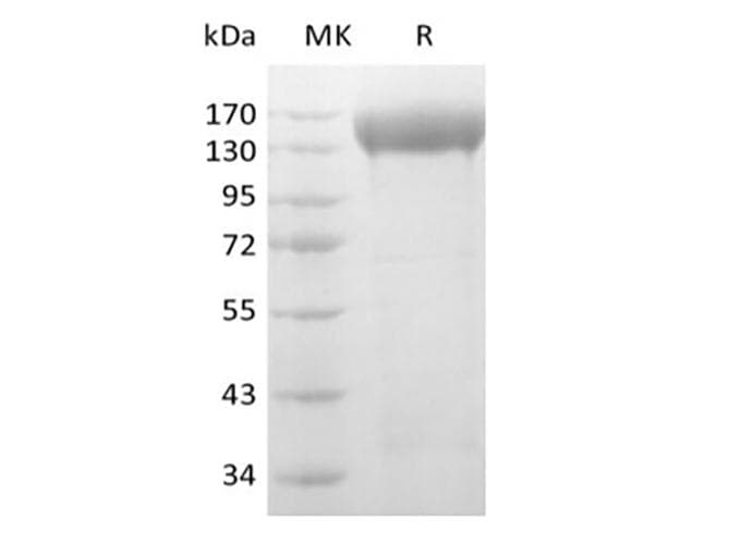 Human KDR / VEGFR2 / FLK1 Protein (Recombinant AVI-6His, C-terminus)