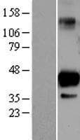 SIRT6 / Sirtuin 6 Protein (Over-Expression Lysate Myc-DDK (Flag))