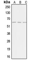 Polyclonal Rabbit anti-Human AGBL4 Antibody (C-Terminus, WB)