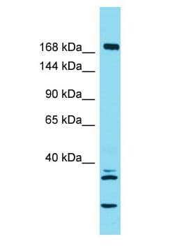 Polyclonal Rabbit anti-Human KIF27 Antibody (aa944-993, WB)