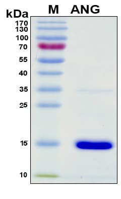 Mouse Angiogenin / ANG Protein (Recombinant 6His, N-terminus)