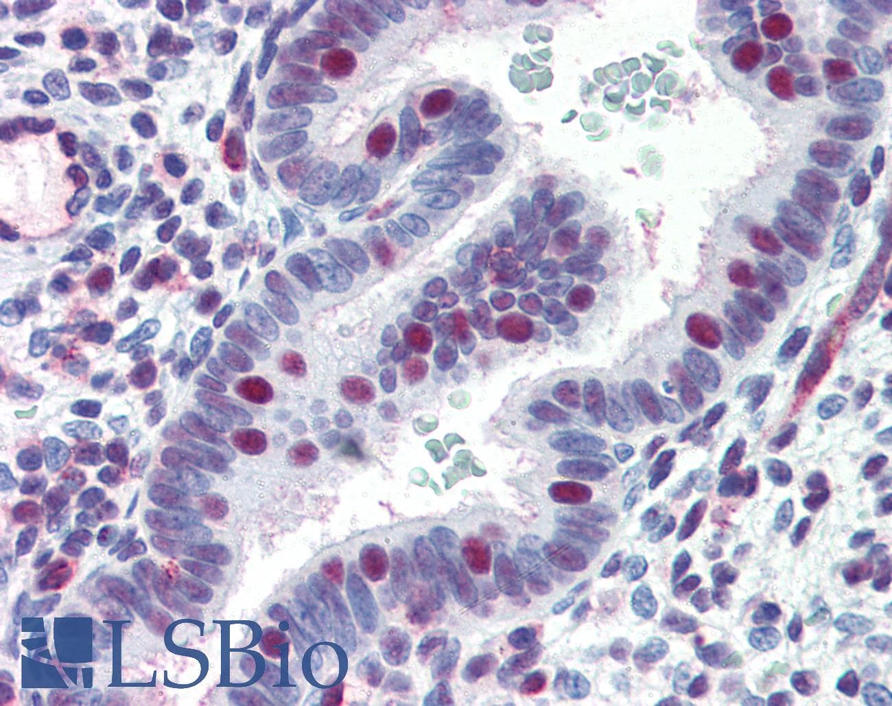 IHC-plus™ ERCC4 / XPF Antibody