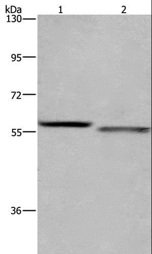 Polyclonal Rabbit anti-Human FRK Antibody (IHC, WB)