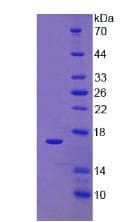 Pig IFN Gamma / Interferon Gamma Protein (Recombinant His)