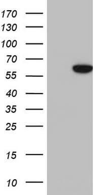 KRT7 / CK7 / Cytokeratin 7 Antibody (clone OTI1B6)