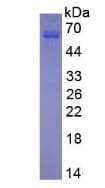 Rat MMP13 Protein (Recombinant His, N-Terminal)