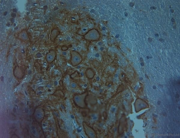 Polyclonal Rabbit anti-Human ACAN / Aggrecan Antibody (aa200-250, IHC)