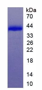 Mouse SLC7A11 / XCT Protein (Recombinant His-GST, N-terminus)