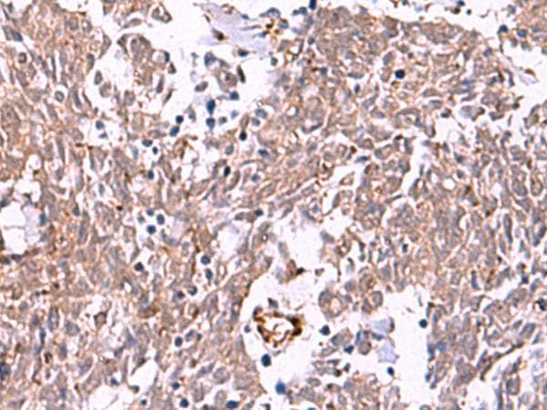 IRX2 Antibody