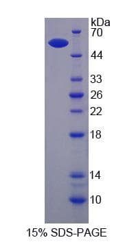 Mouse ITGB6 / Integrin Beta 6 Protein (Recombinant His-S)