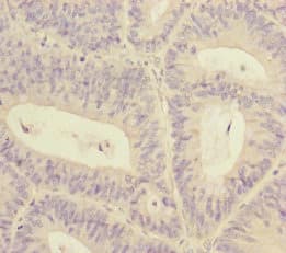 RBM17 Antibody