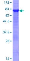 Human PTENP1 Protein (Recombinant GST)
